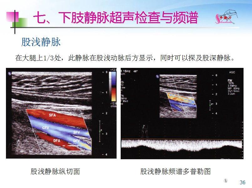 下肢血管解剖图彩超图片