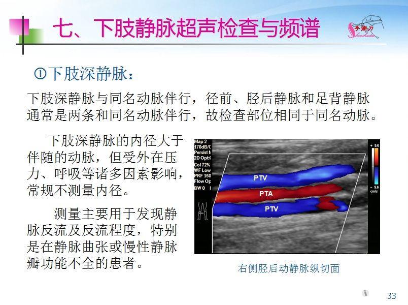 下肢血管的超声检查及正常声像图