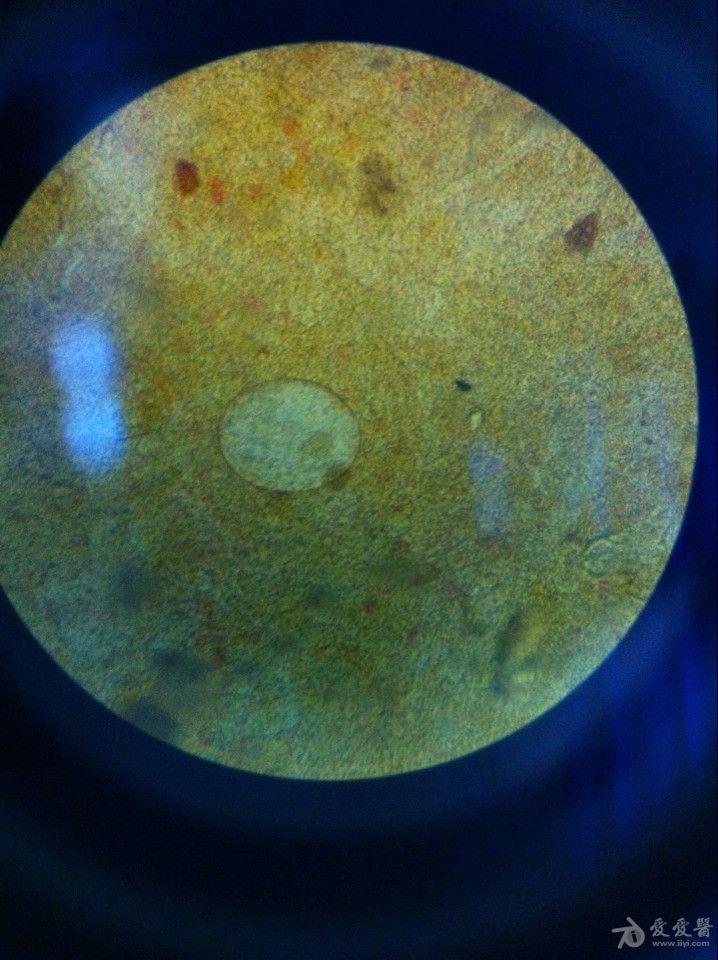日本血吸虫加藤片显微镜下虫卵