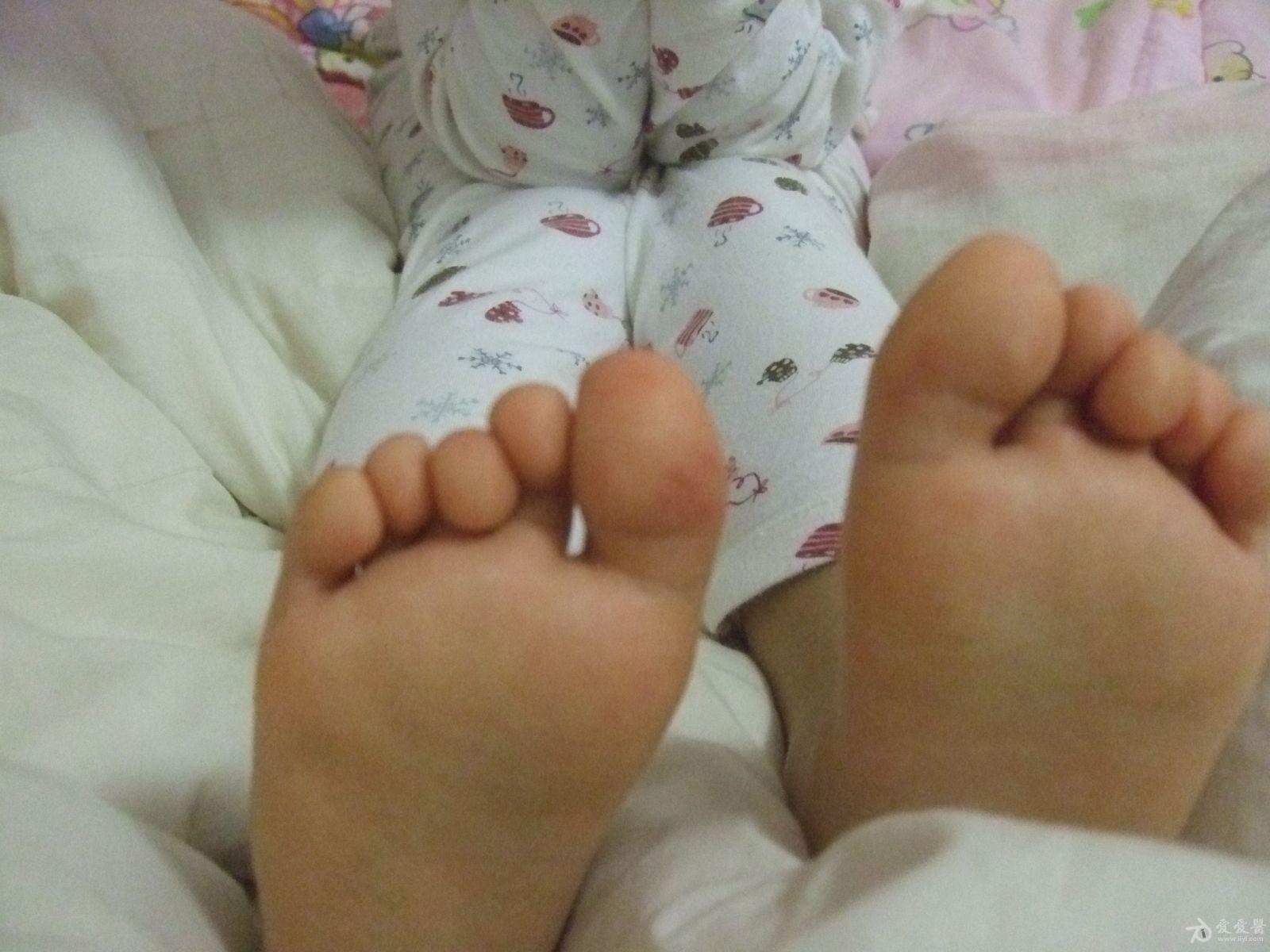 5岁小孩大脚趾上这样的皮疹能是什么病呢