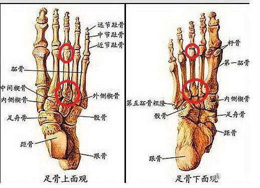 脚外侧骨头疼图片