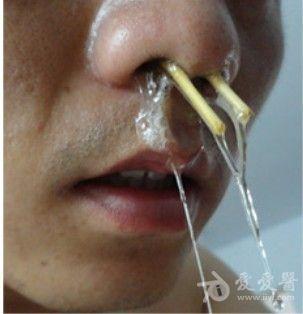鼻炎鼻孔照片鼻子图片