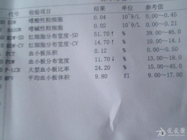 免疫性血小板减少症