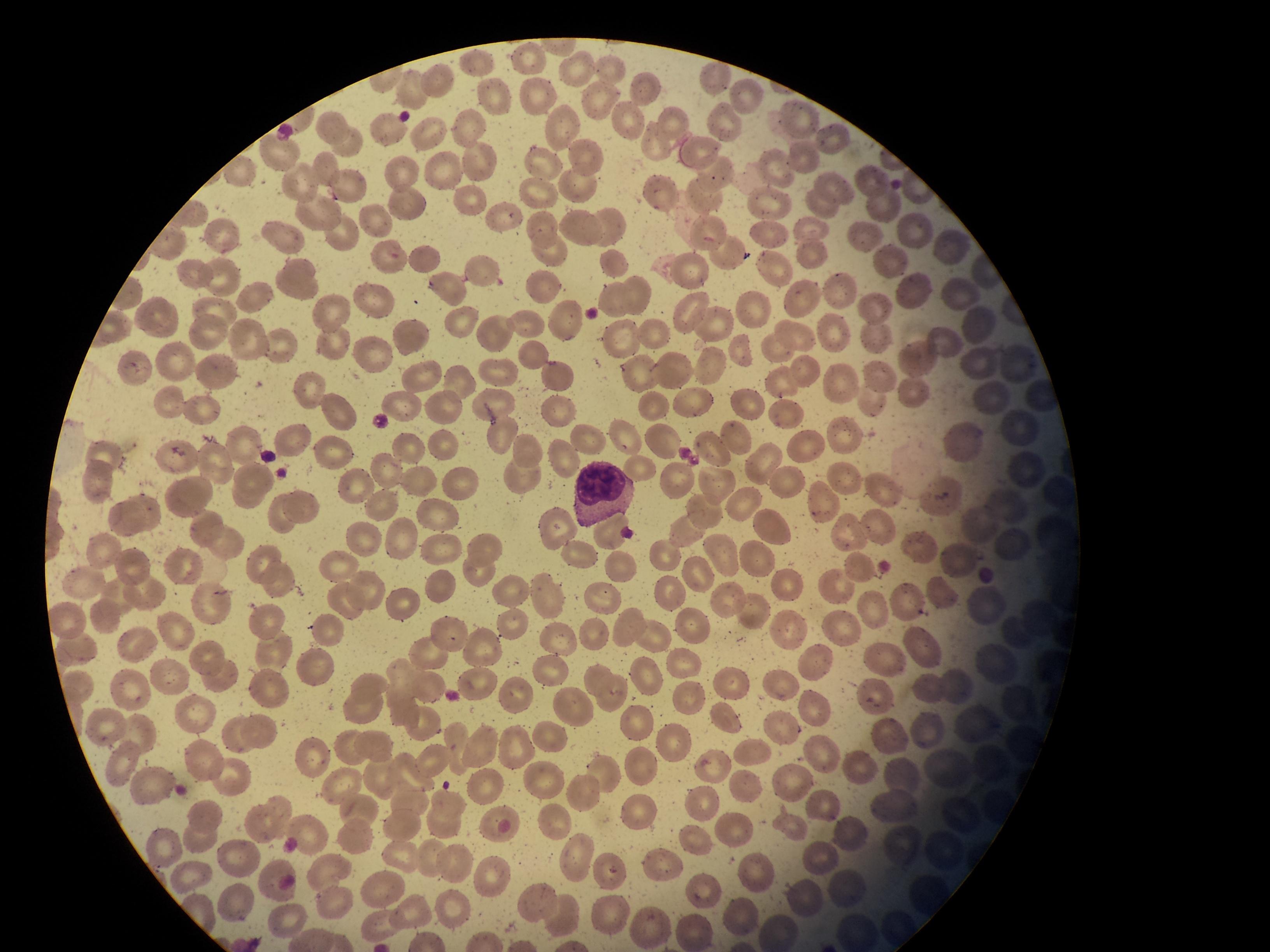 为什么淋巴细胞的胞浆也是红色的