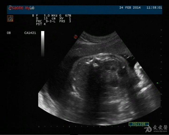 看看这个胎儿的肾脏