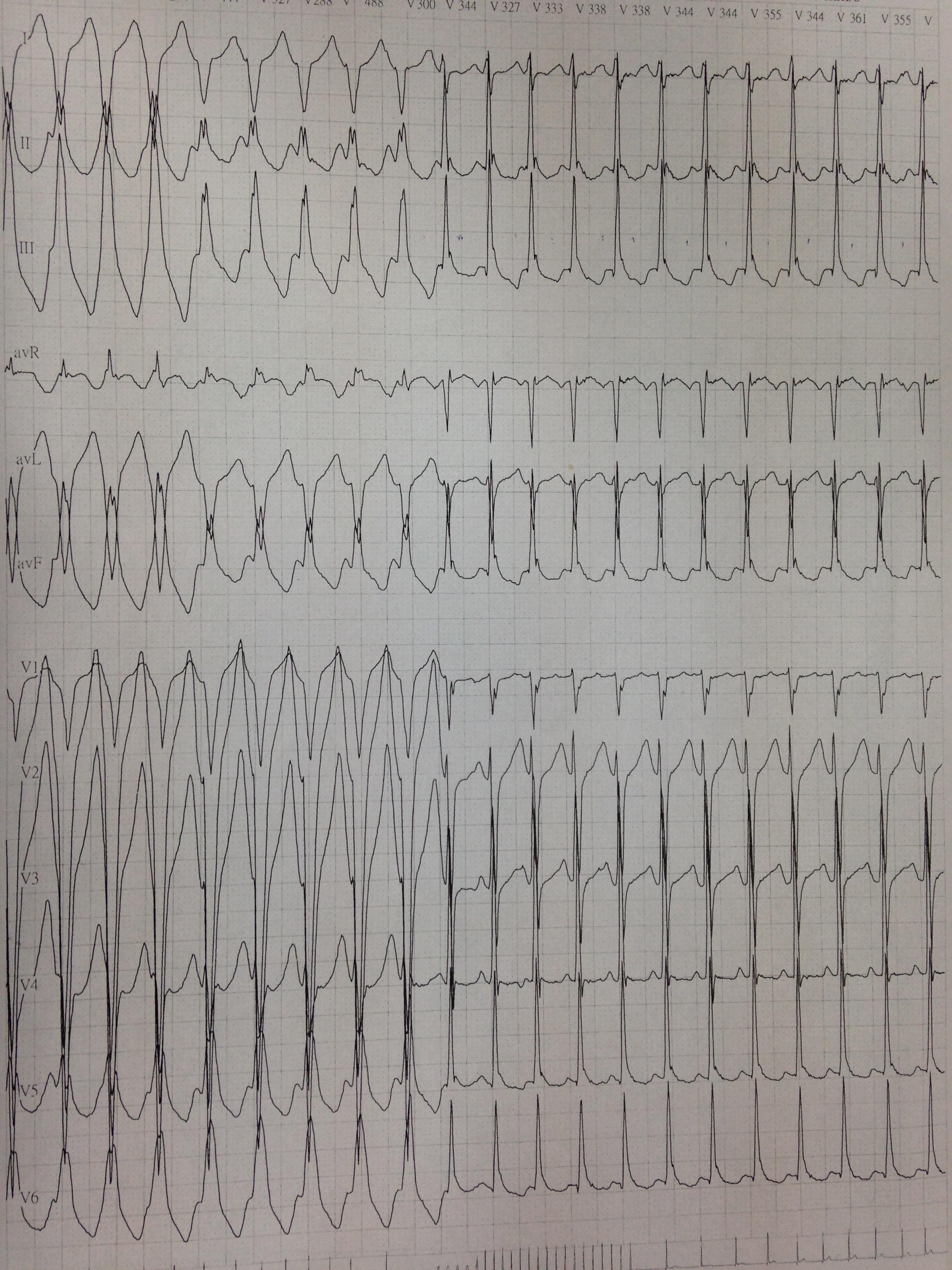 动态心电图报告结果 140224195606e69ef170c33860.jpg