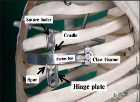 claw fixator hinge plate.PNG