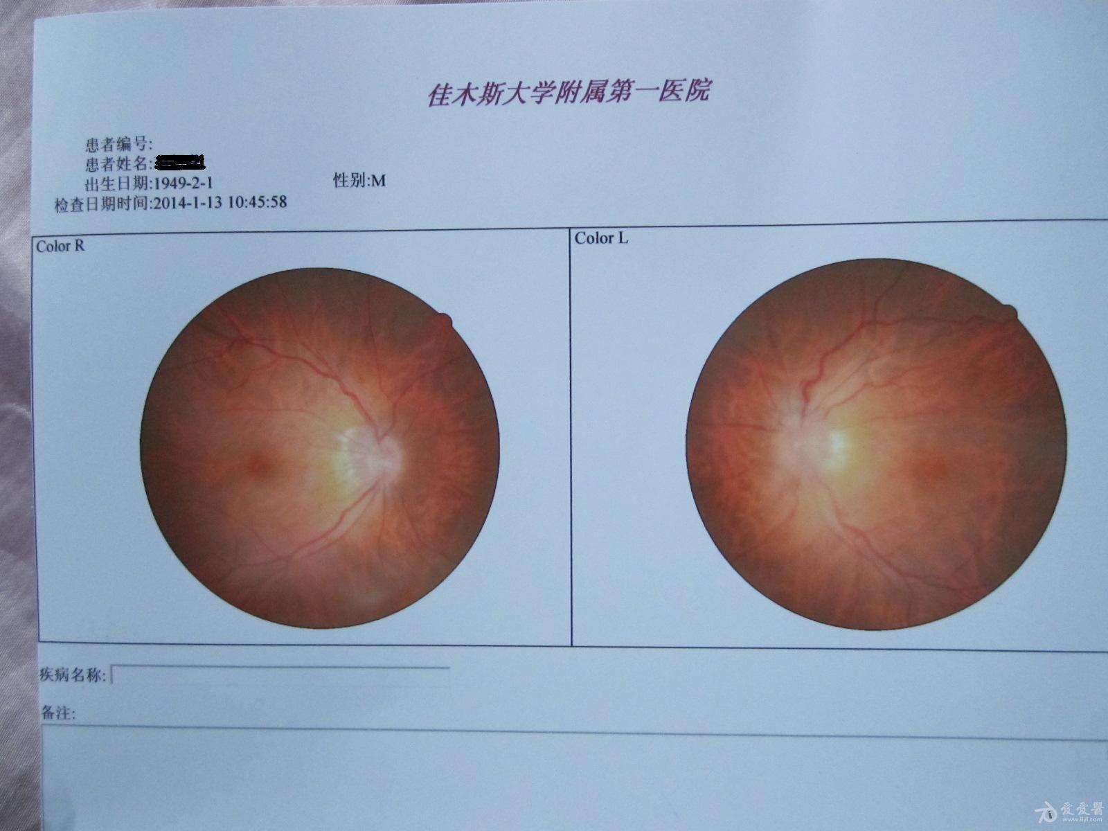 中浆 中西结合的比较治疗