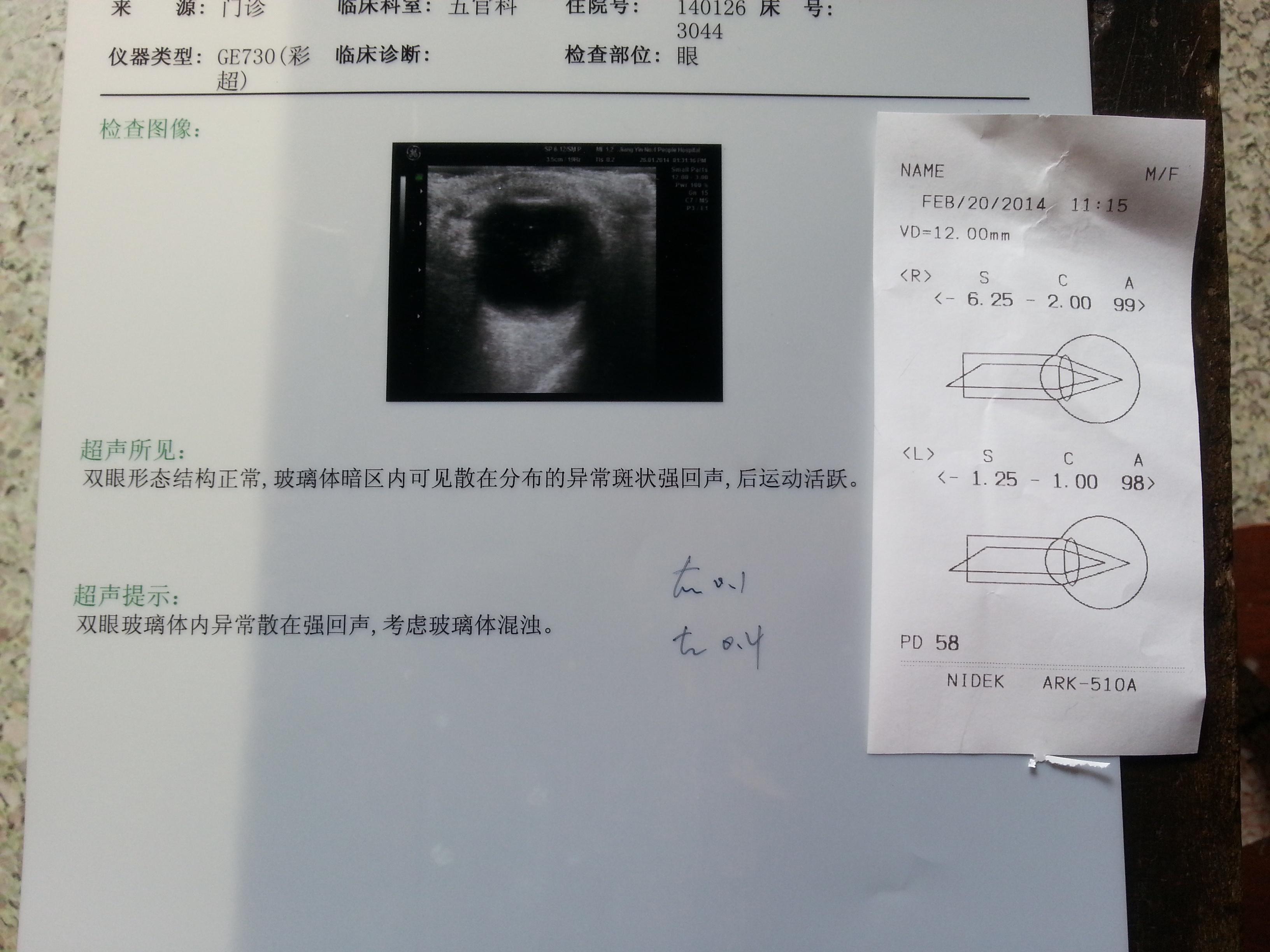 患者眼睛有异物感