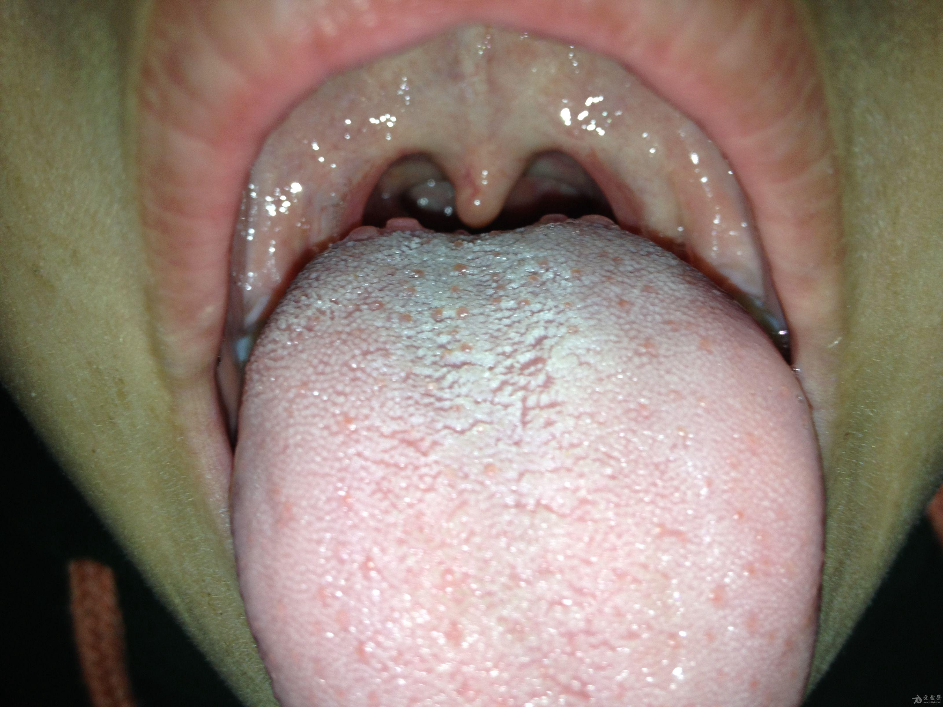 正常人的舌头根部图片