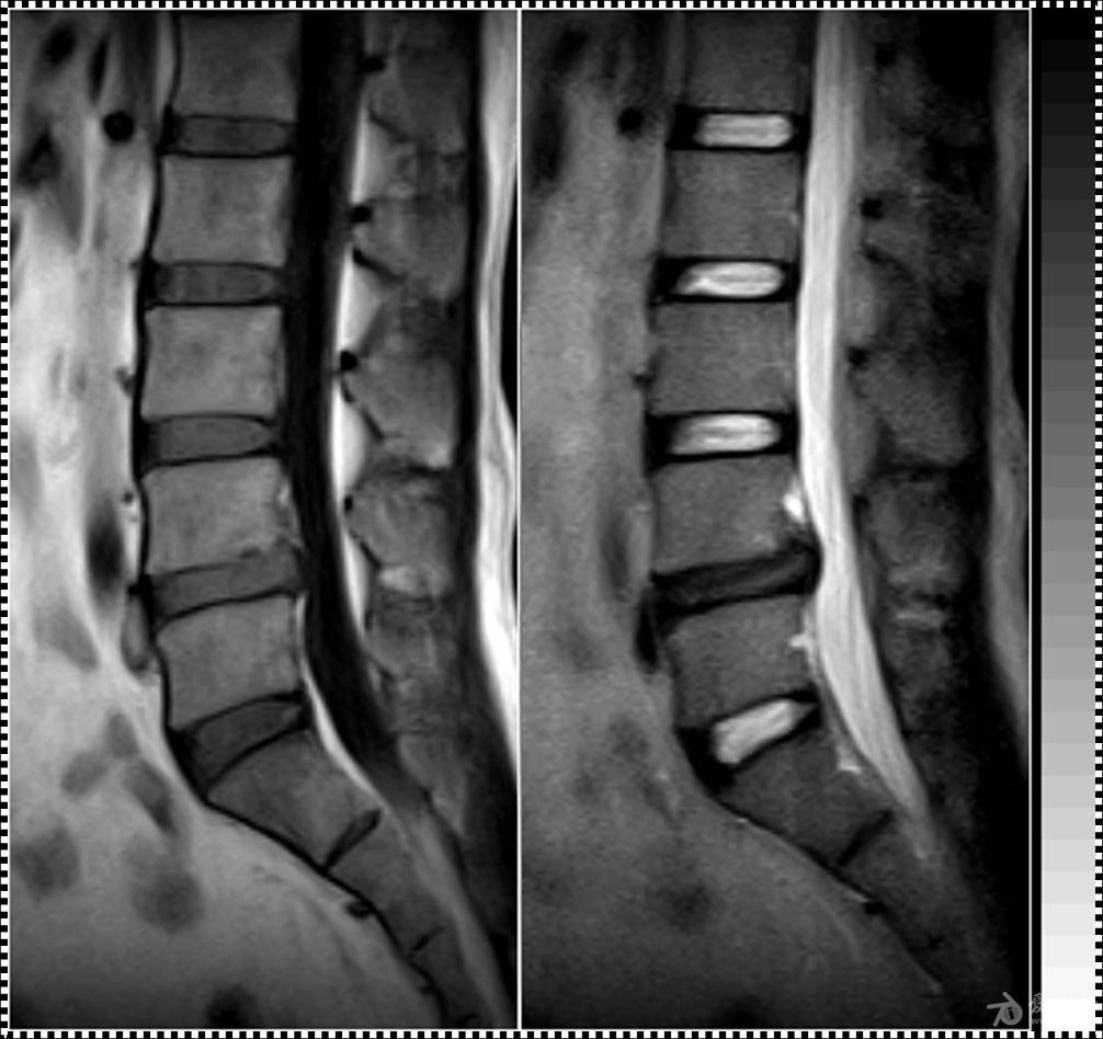 核磁共振t1与t2区别