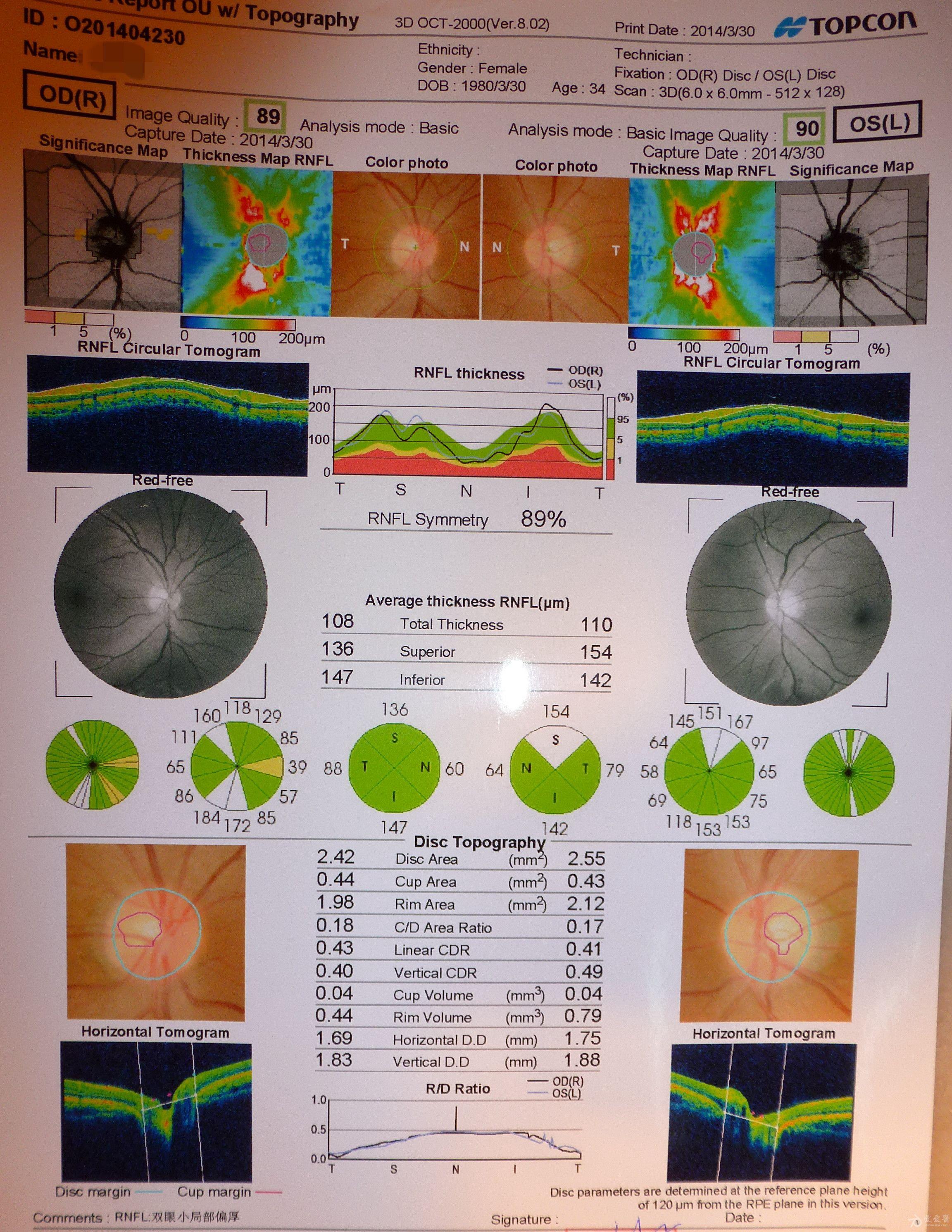 眼科oct报告图图片