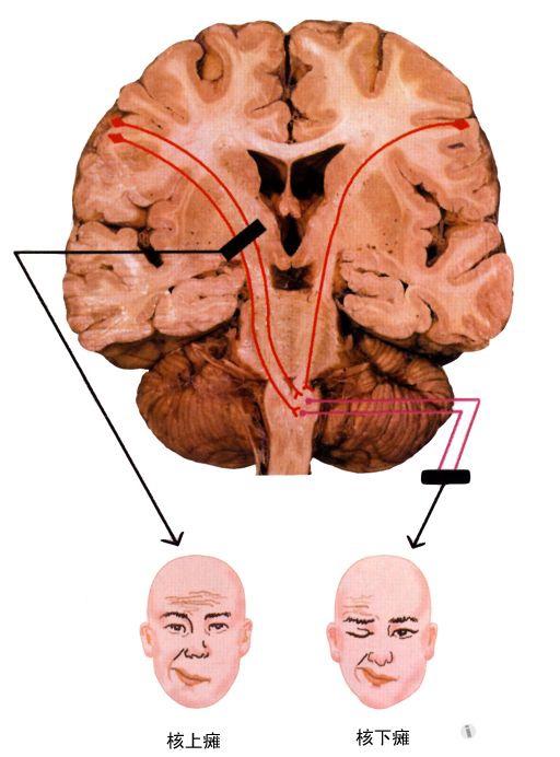 神经系统的一些口诀三