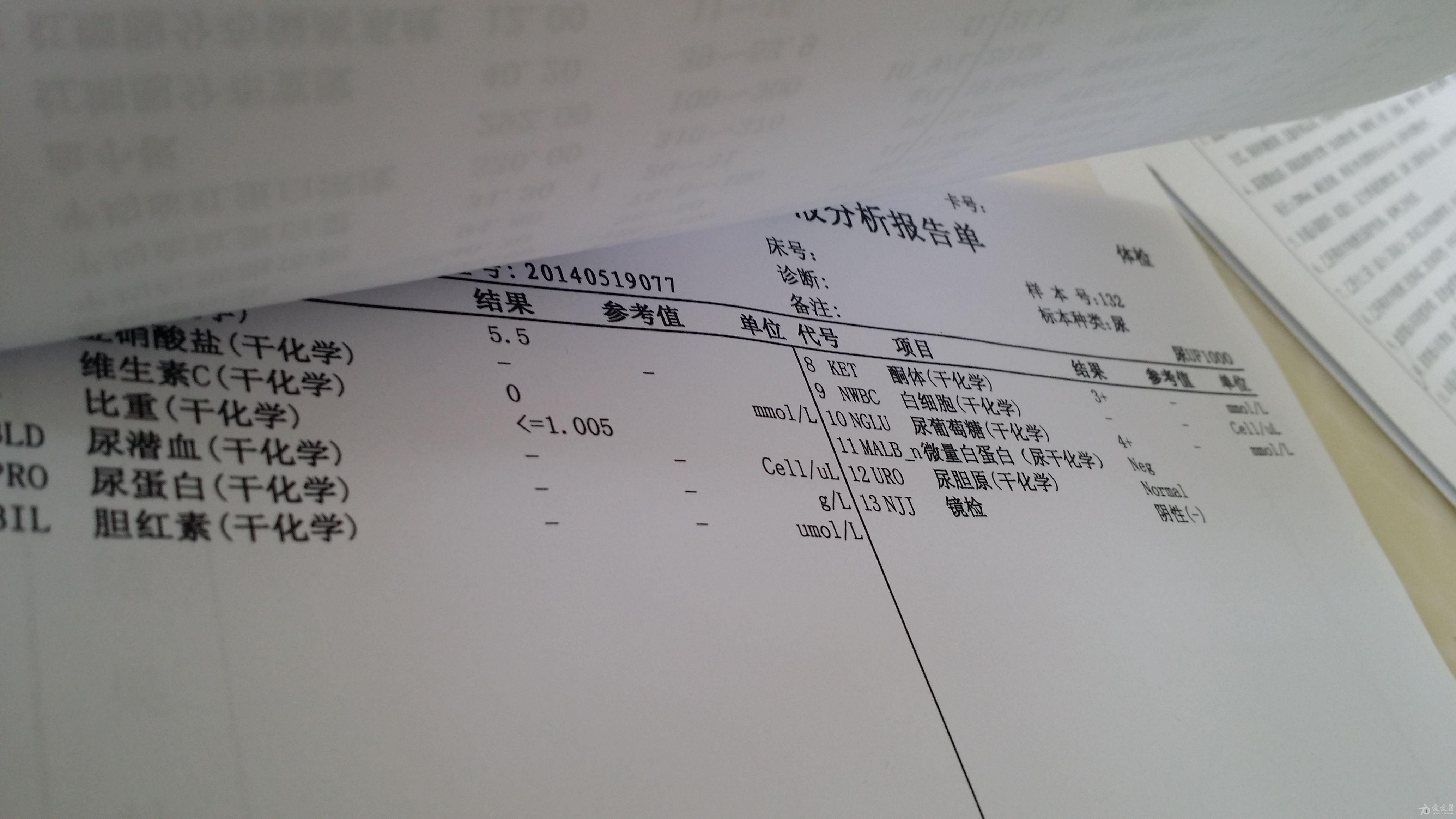 尿糖4酮体3血糖正常