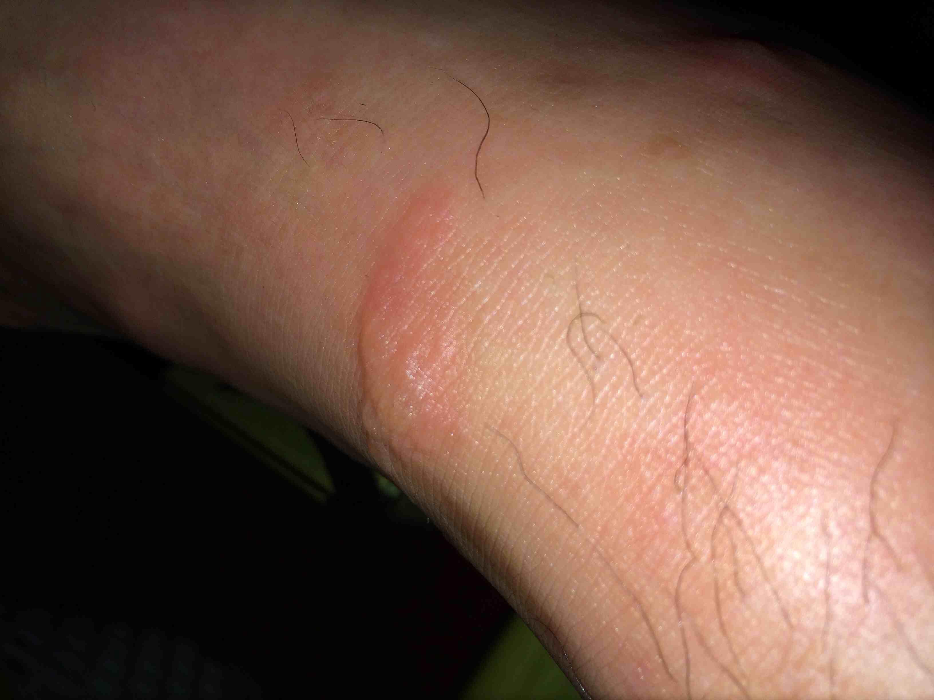 有专科医生吗求帮忙看看是怎么回事