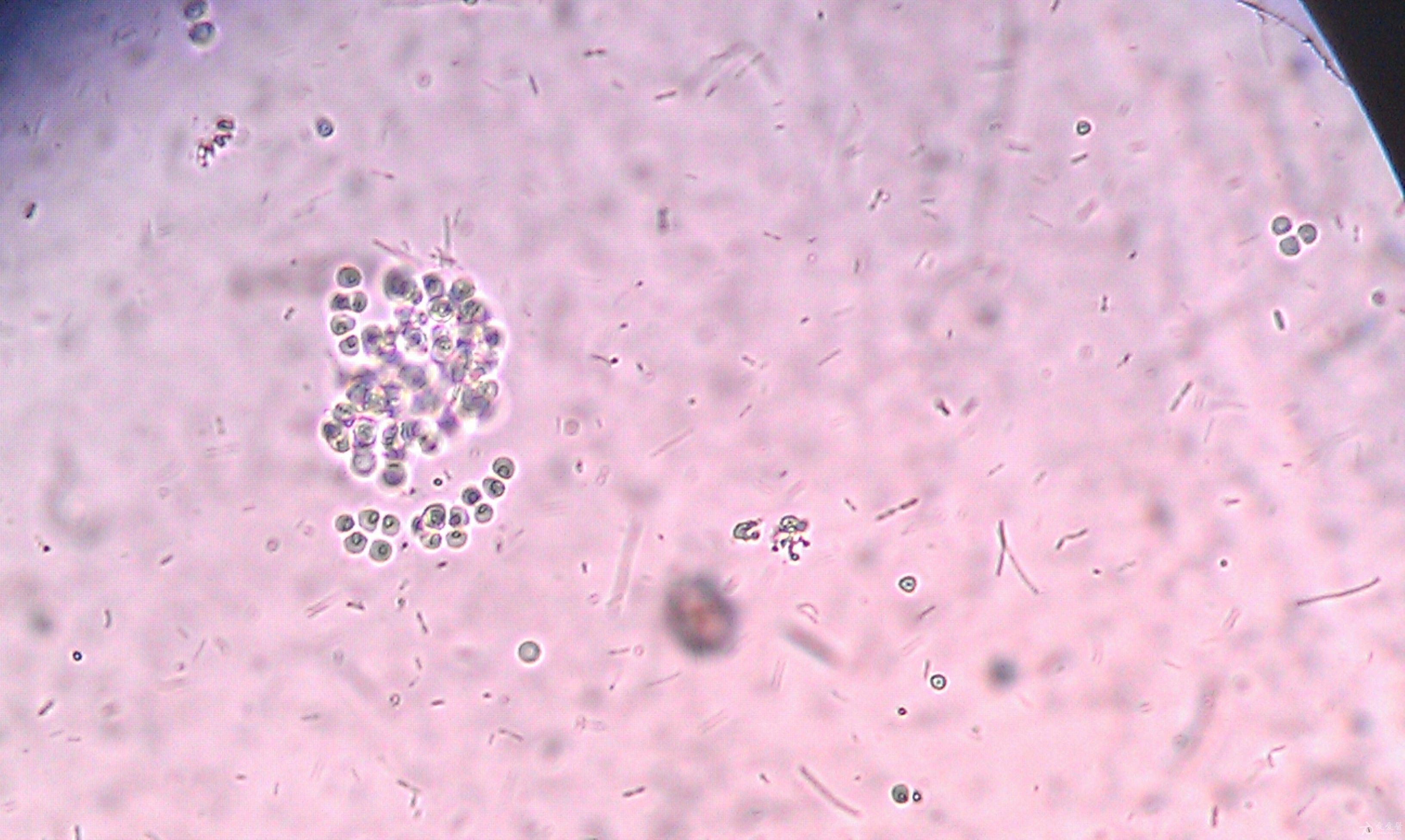 粪肠球菌镜检图片