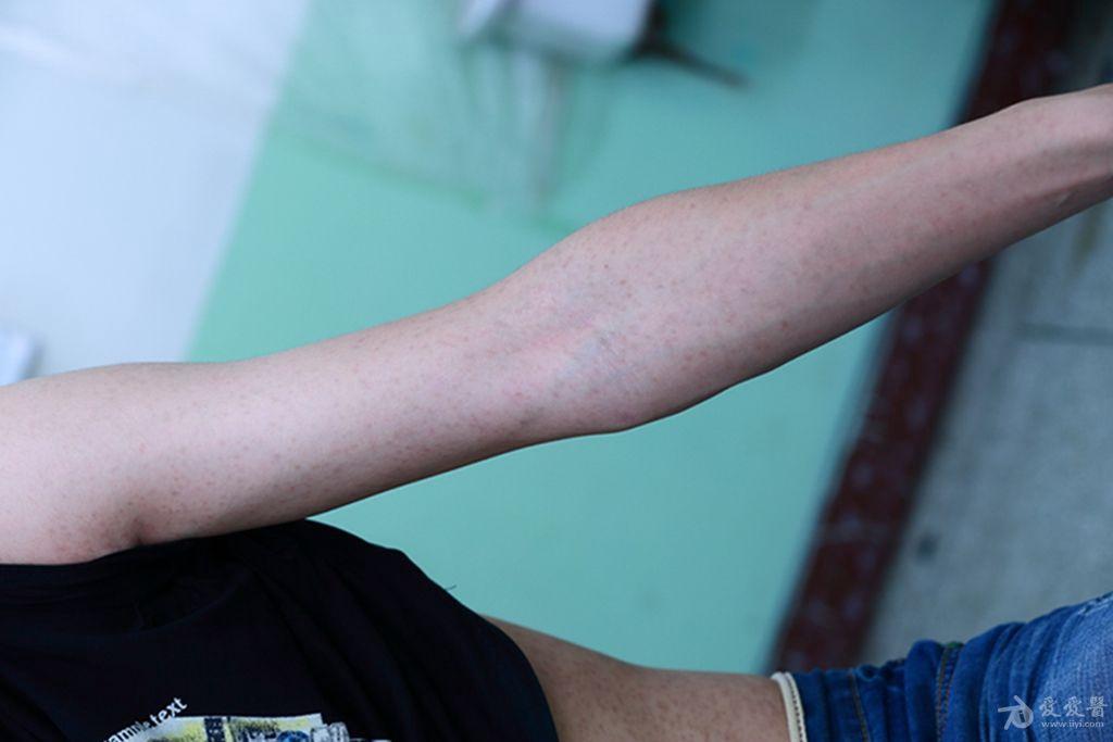 色素沉着用什么中成药 140626223011gsjjk7ij2prjhjzj.jpg