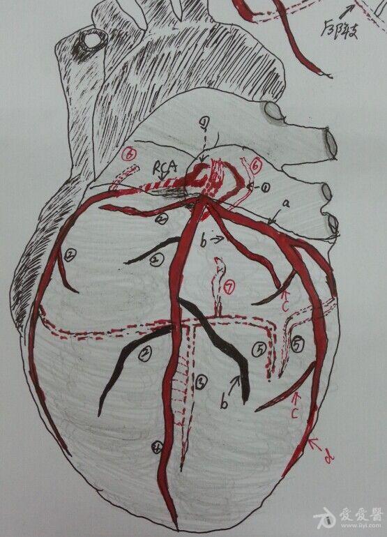 中动脉手绘图片