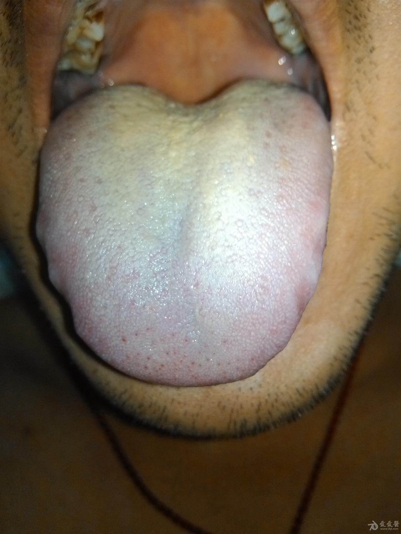 健康的舌头根部图片图片