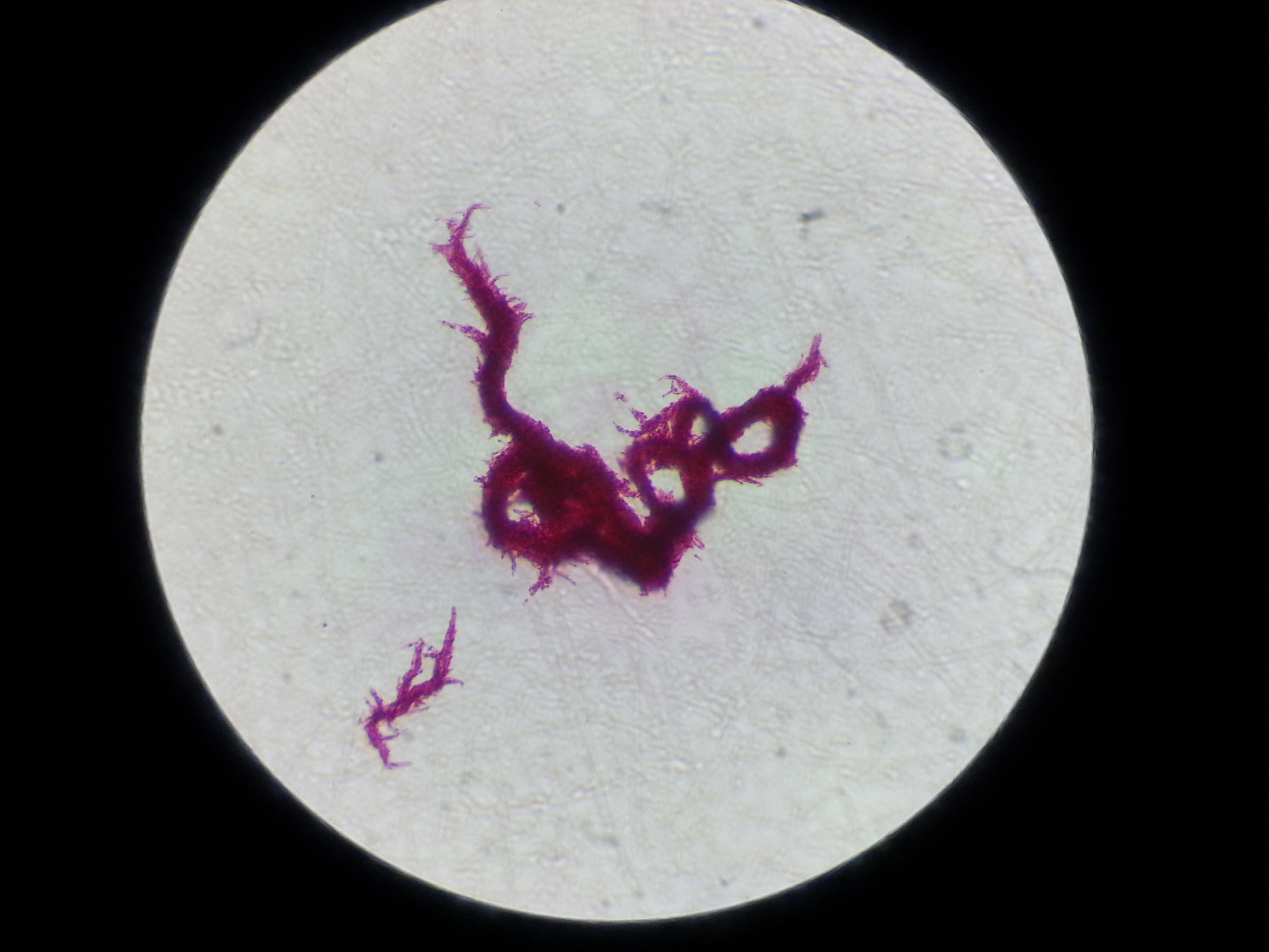 结核分枝杆菌液体培养形成的索状结构