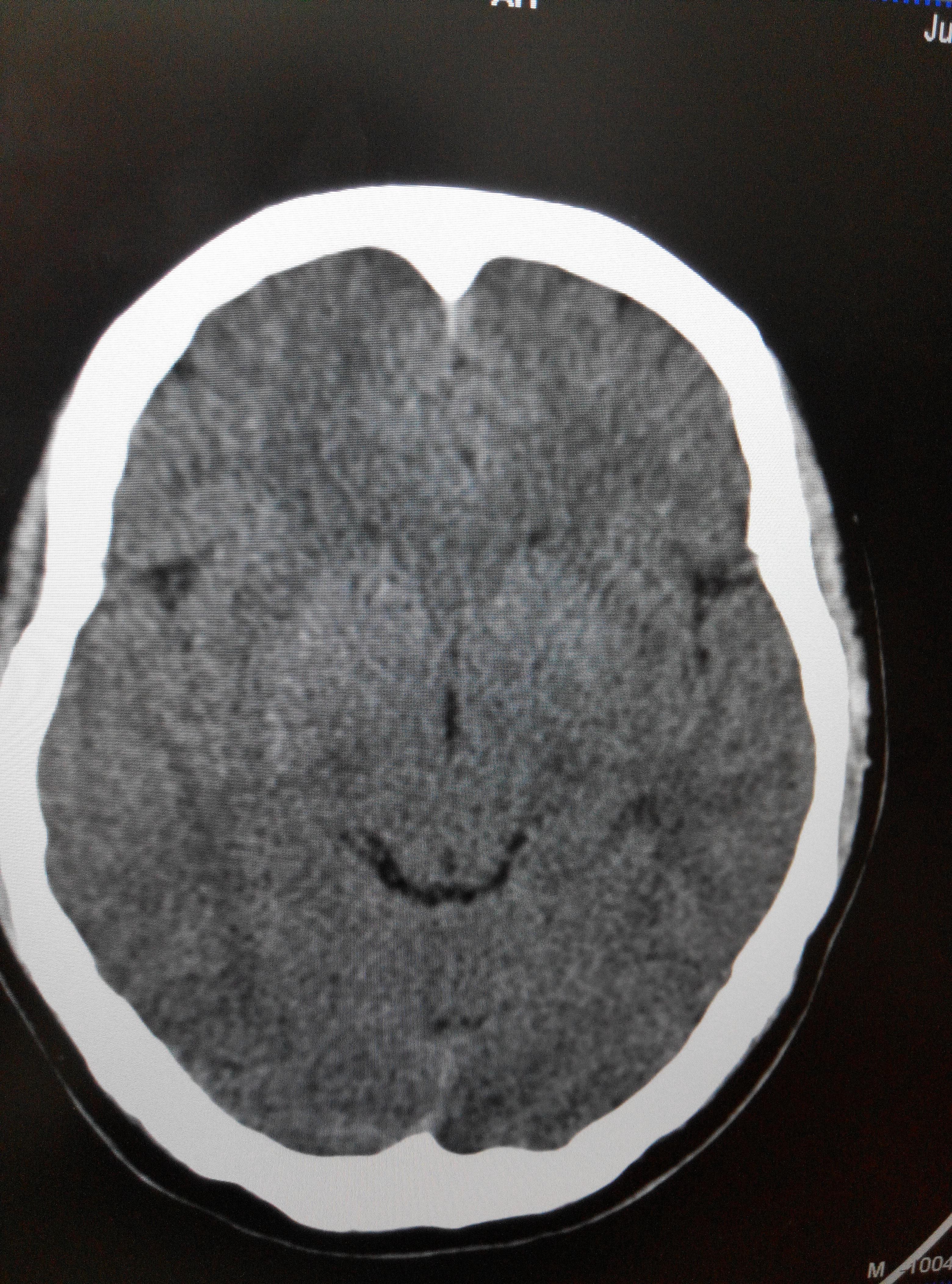 看下这个头部ct