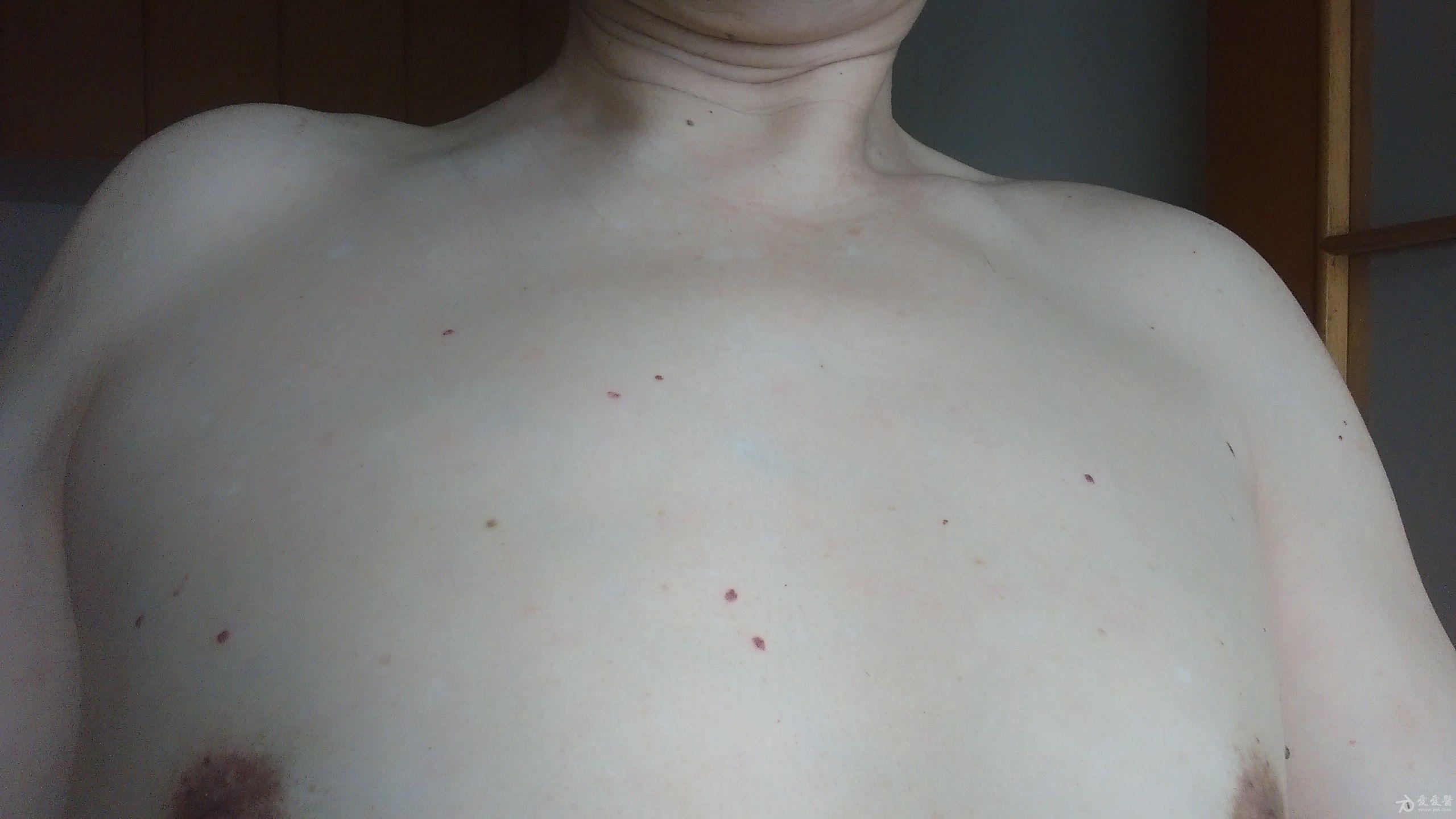 140721122548yjjj3j5jggjd3j43.jpg