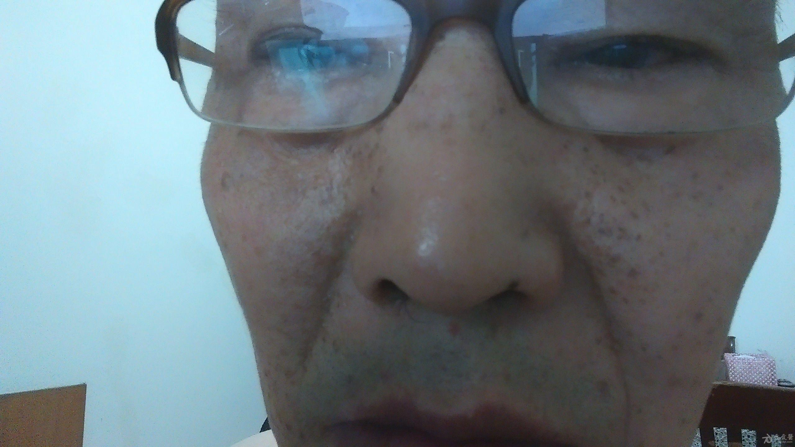 斑什么陆成语_蛇斑疮是什么症状图片(2)