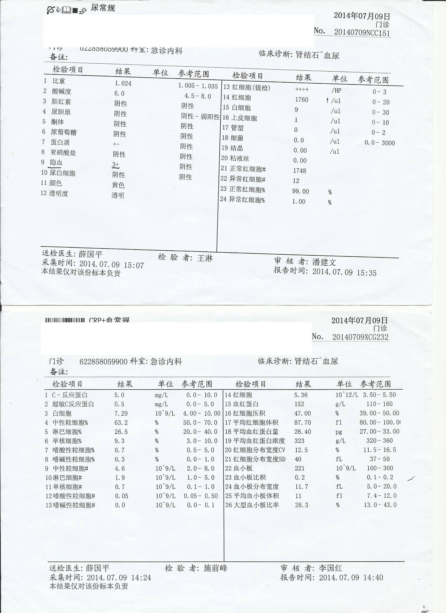 7月9日开始疼痛双肾结石右输尿管上段结石隐痛至今我该怎么办