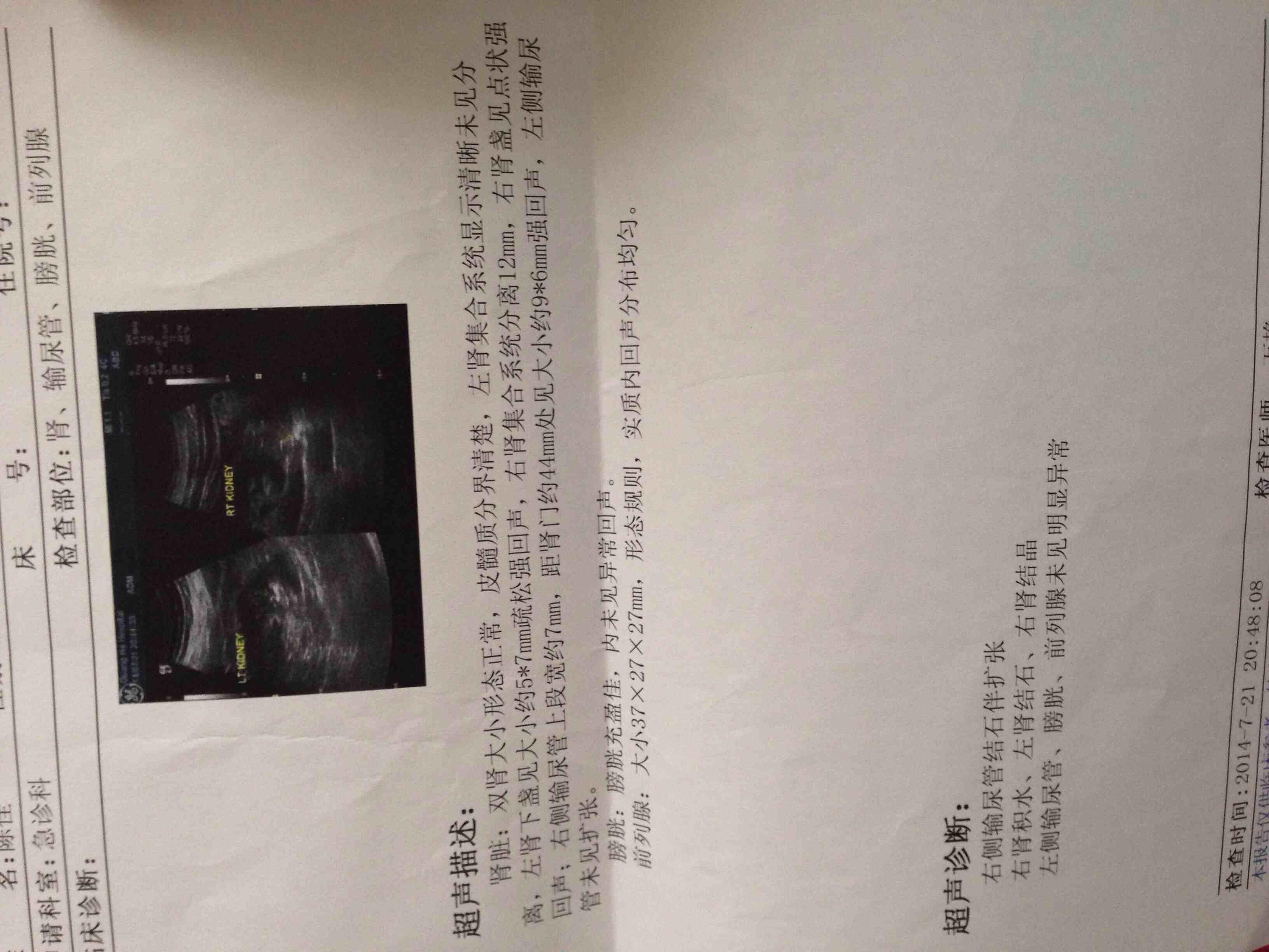 输尿管结石1公分碎石后低热不退