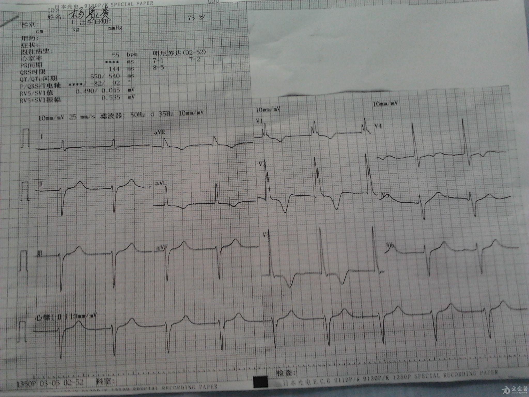 門診病人心電圖