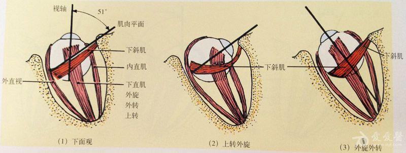 单独上斜肌的作用(右眼).jpg