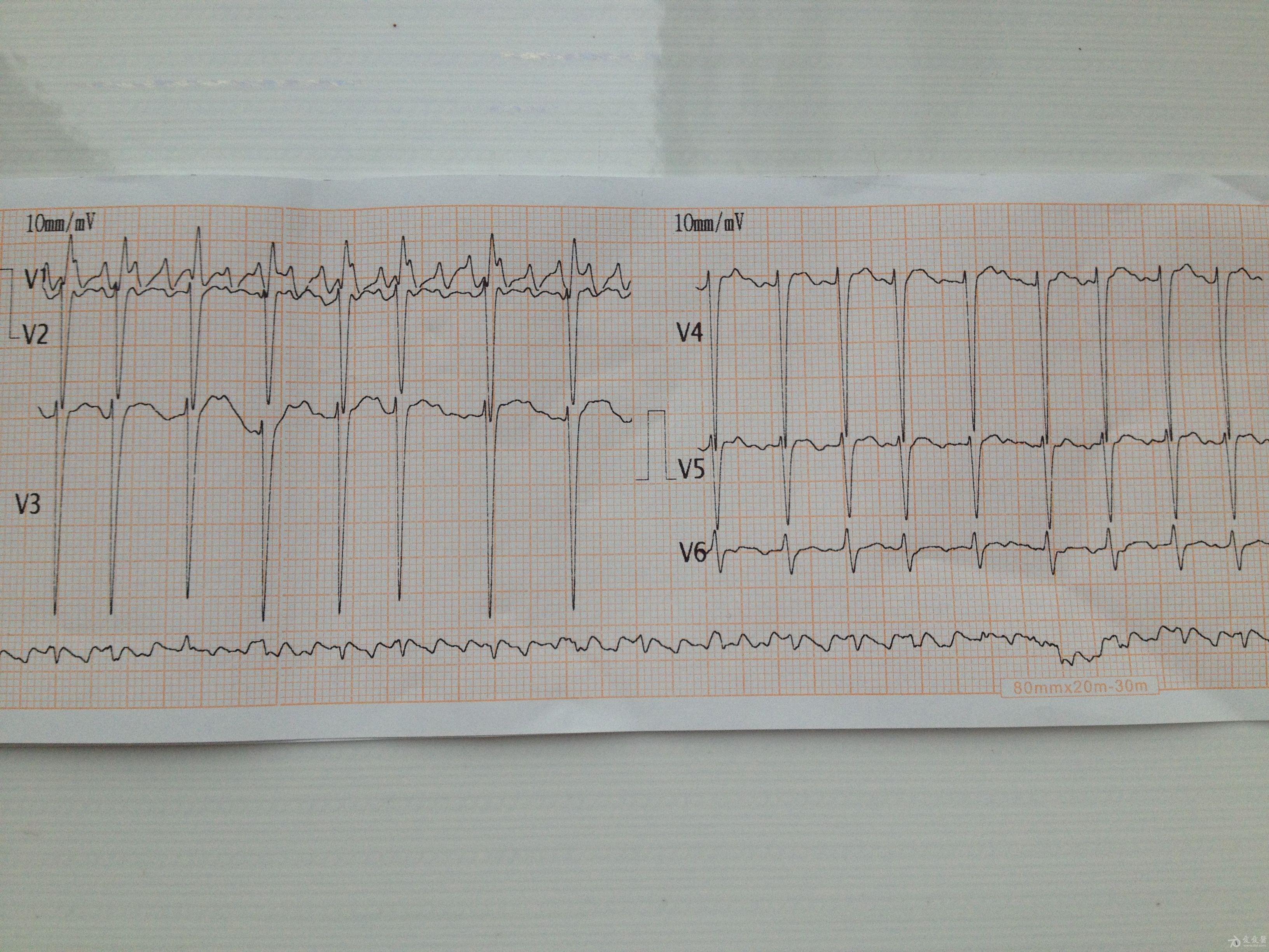 心电图脑电图专业讨论版 - 爱爱医医学论坛