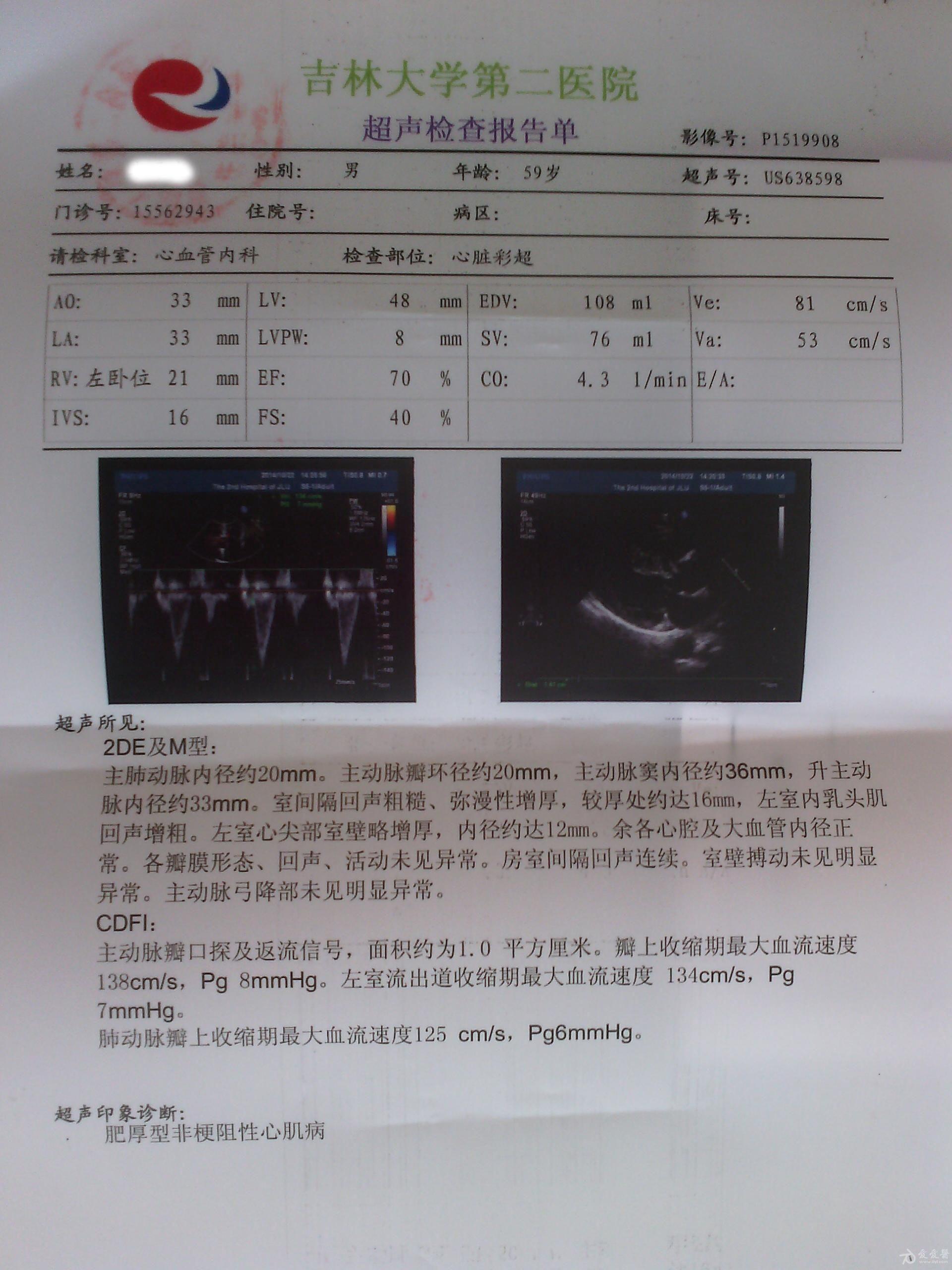 心肌炎病历图图片