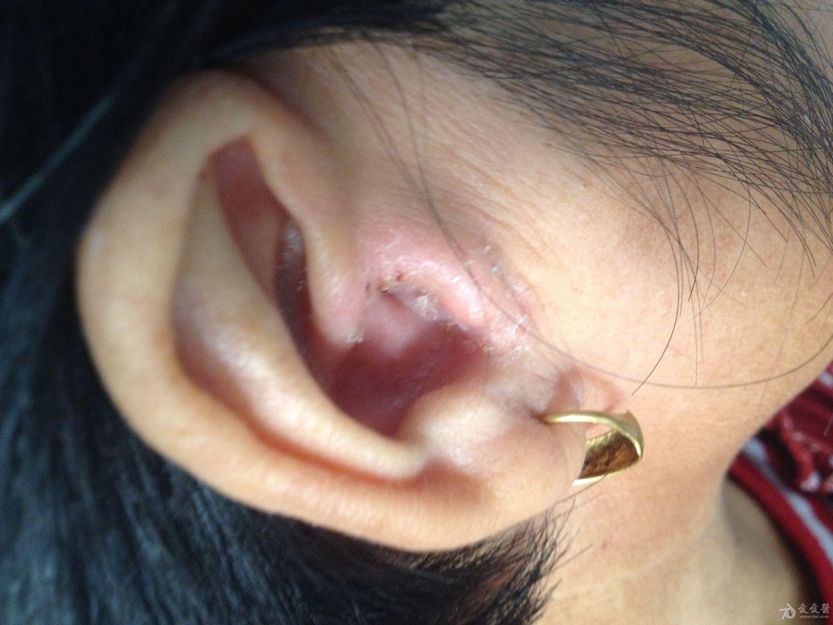 耳螨早期症状图片图片