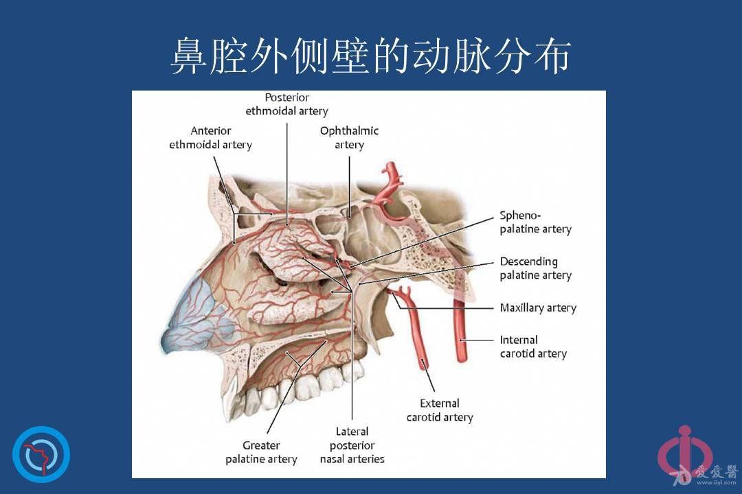 上颌窦开口图片