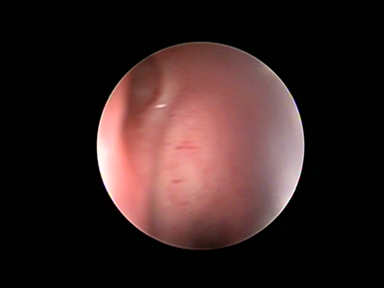 请教图中下鼻道中是什么结构