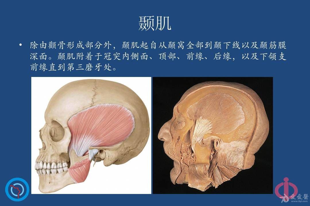 颞下间隙图片