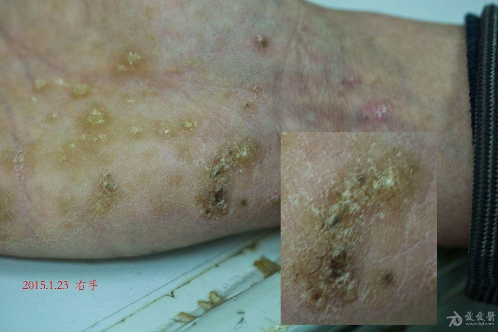 这个病例该如何处理有什么好办法