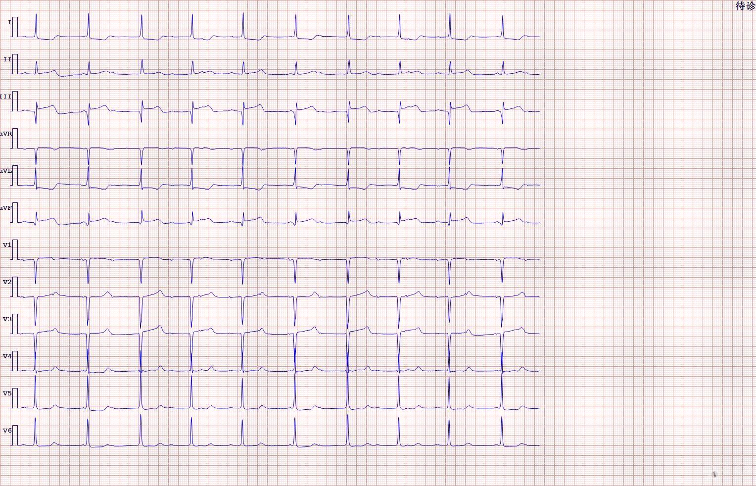 心电图脑电图专业讨论版 - 爱爱医医学论坛