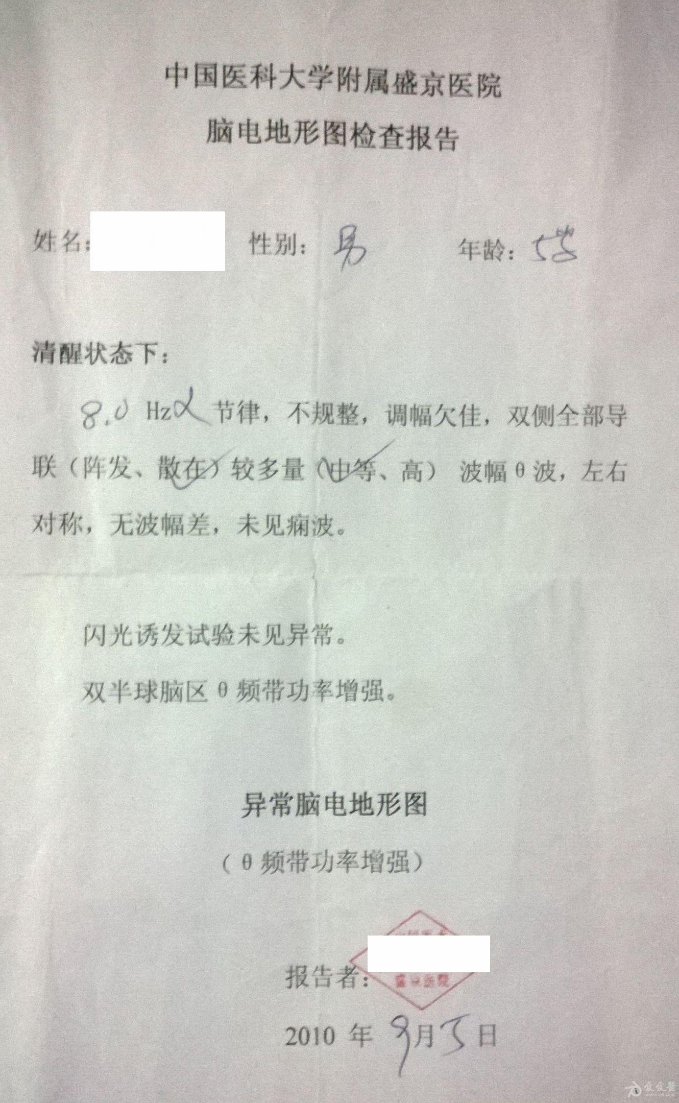 小儿抽动症如何用针灸治疗