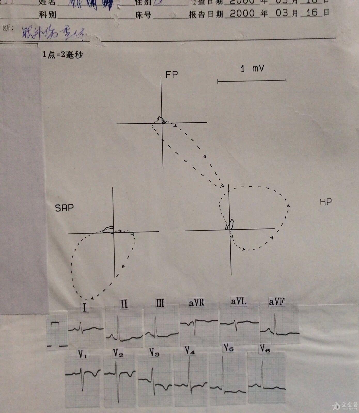 贺新年看心电图熟悉向量图图65异常t环3