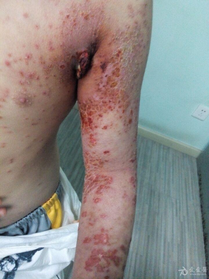 150317232827umxnagydzavvncf3.jpg