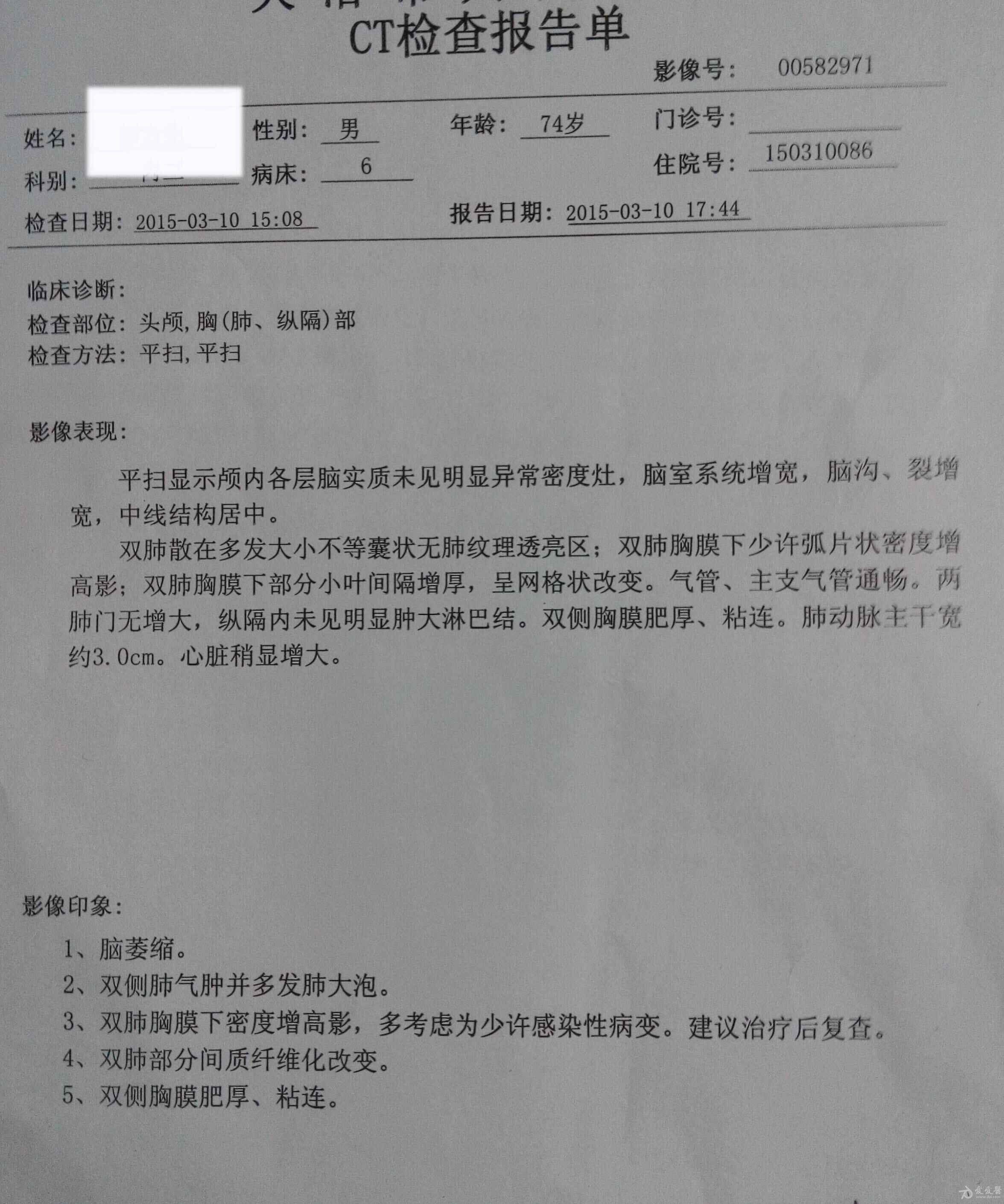 咽痛咳嗽3天,头晕胸痛1天