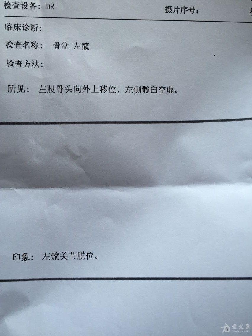 1岁半外甥女被诊断为ddh髋关节脱位说要动手术请专家来看看