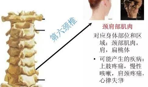 脊椎与全身的疾病颈椎段