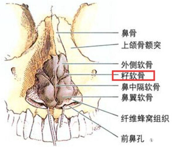 鼻软骨生长图片