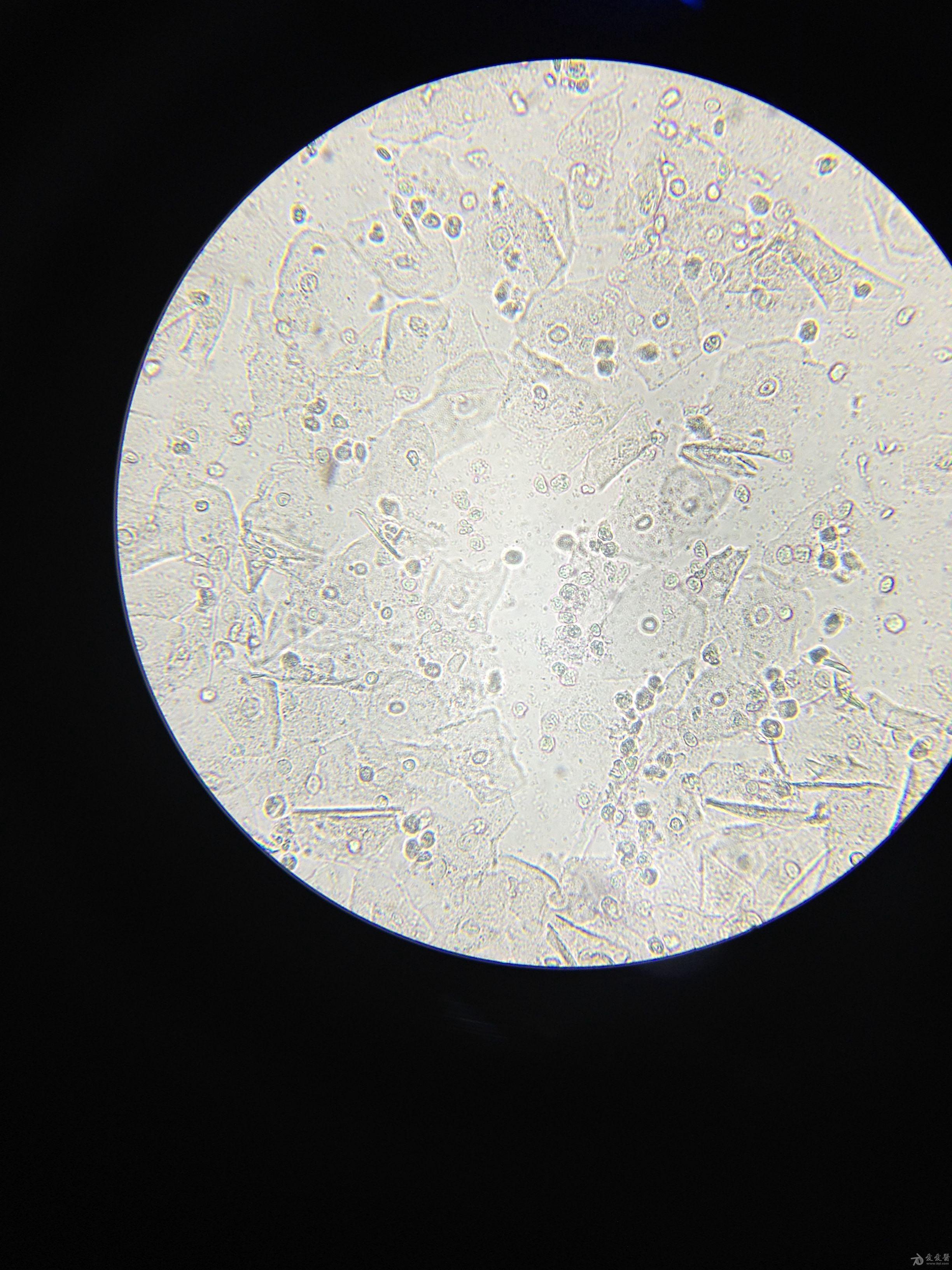 白带真菌镜检图片图片