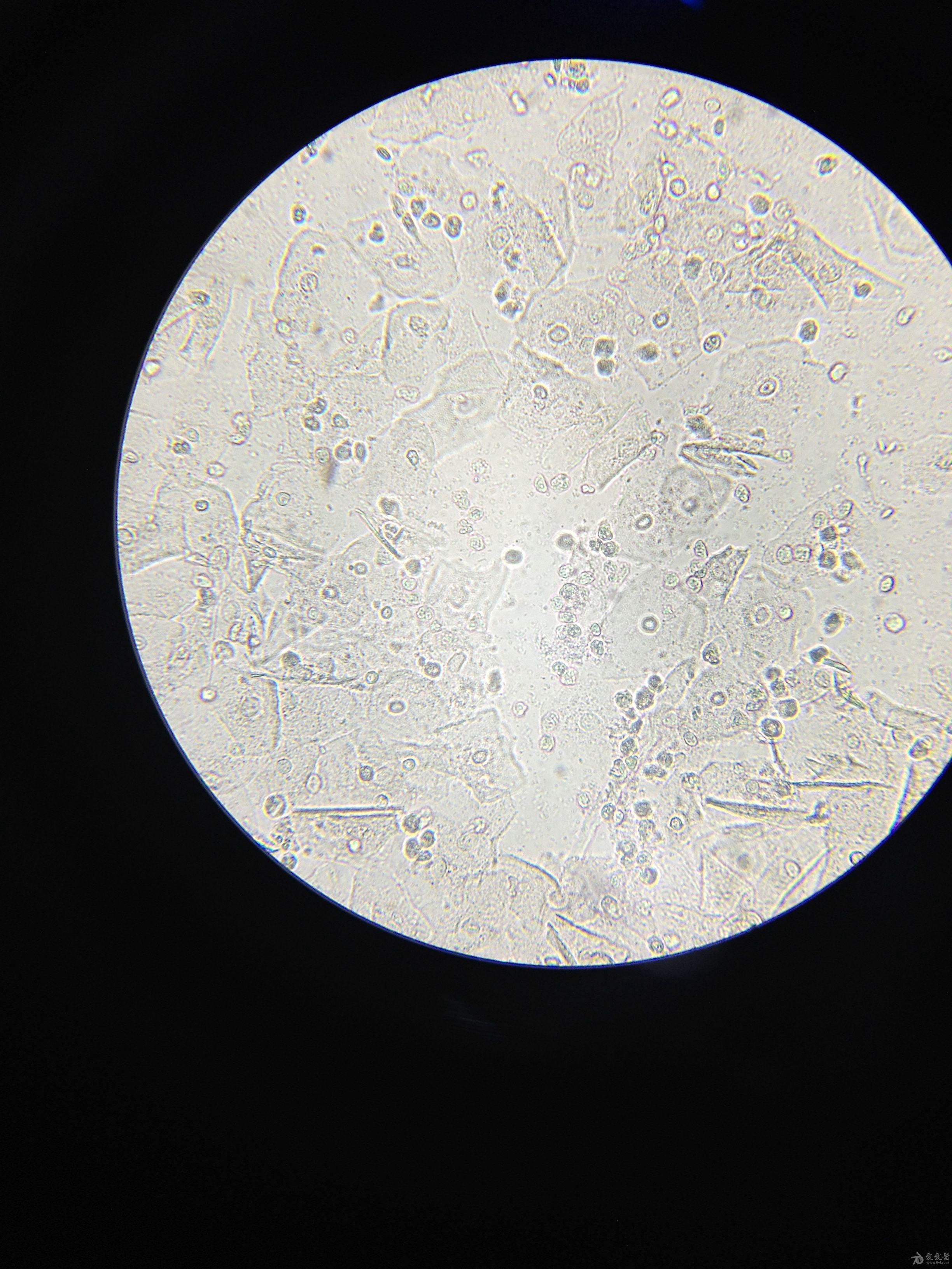 白带盐水涂片镜下图片图片