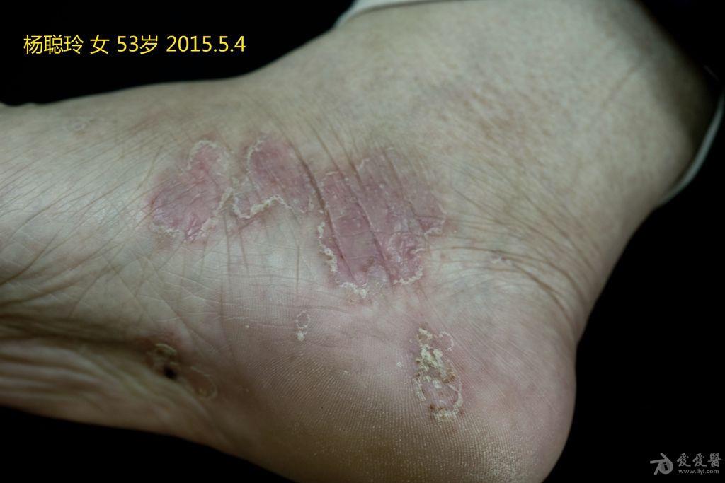 150505212804fumjfpu26umzuobm.jpg