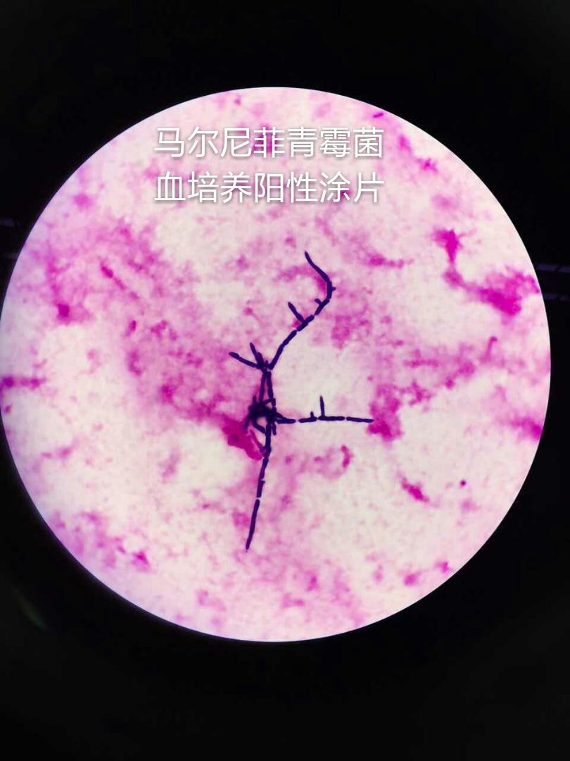 马尔尼菲青霉菌图片